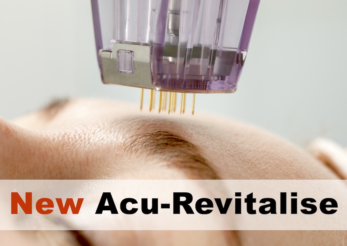 acu-revitalise-microneedling-banner-copy acu-revitalise-microneedling-banner-copy